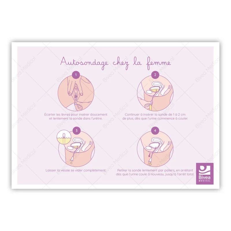 Schéma Autosondage chez l'homme et la femme
