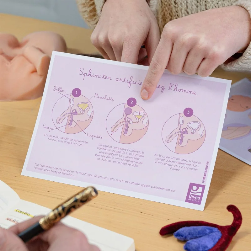 Schéma d'un sphincter artificiel chez l'homme pour expliquer son utilisation