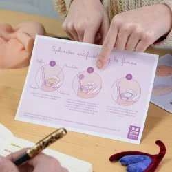 Schéma d'un sphincter artificiel chez la femme pour expliquer son utilisation