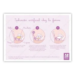 Schéma d'un sphincter artificiel chez la femme sur fond blanc