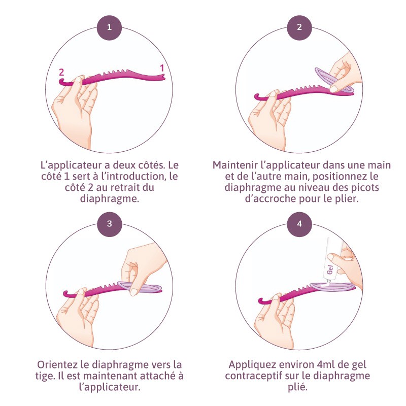 Comment insérer le diaphragme contraceptif avec l'applicateur