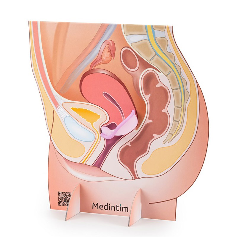 Représentation de l'appareil génital féminin avec un diaphragme caya