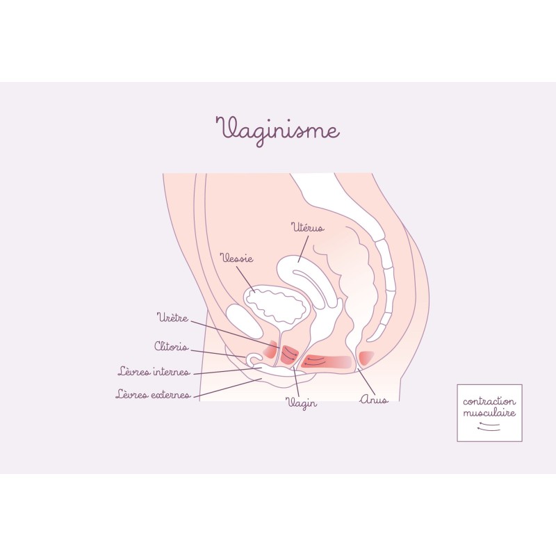 schéma anatomique vaginisme