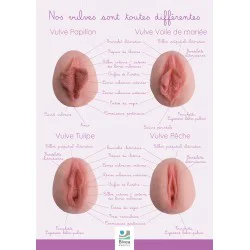Poster illustration différentes formes de vulves