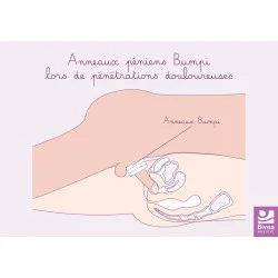 schéma anatomique utilisation anneaux de confort Bumpi