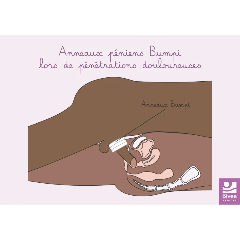 schéma anatomique de l'utilisation d'anneaux de confort peau foncée