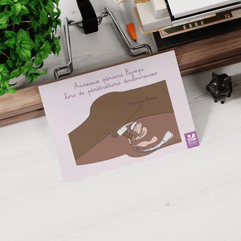 schéma anatomique de l'utilisation d'anneaux de confort peau foncée posé sur un bureau