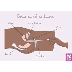 schéma anatomique d'un frottis peau foncée