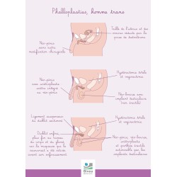 Poster A4 Phalloplasties homme trans
