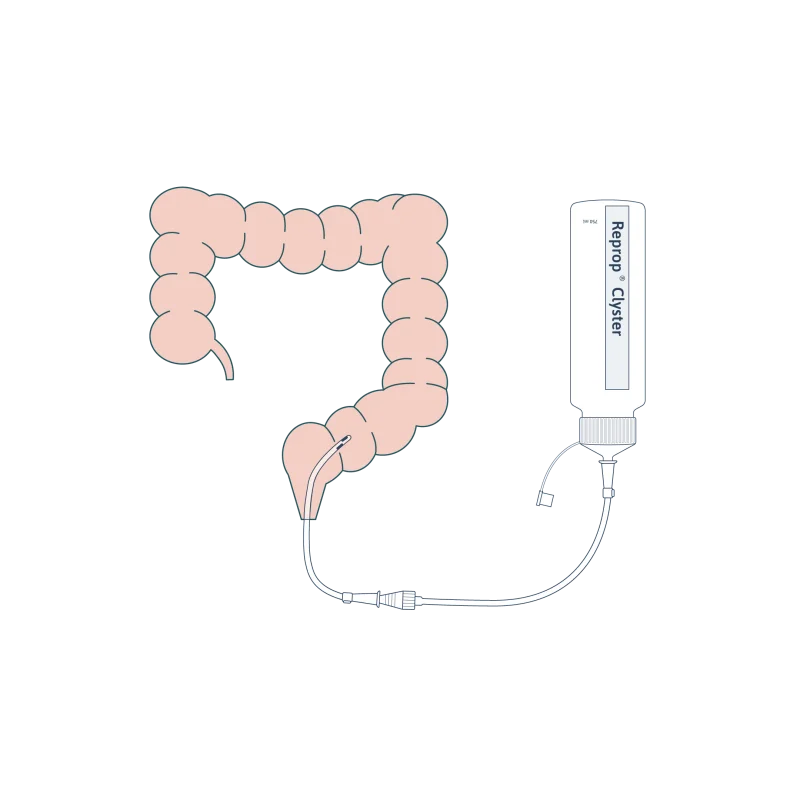 Schema utilisation reprop basic lavement intestinal