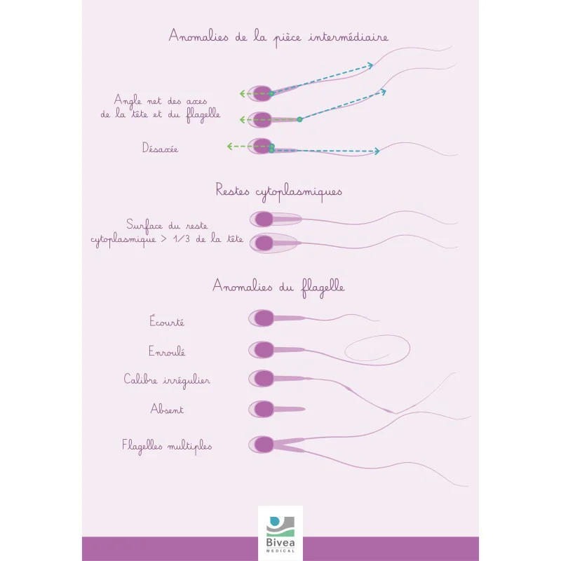 Schéma représentant la morphologie des spermatozoïdes et de leurs éventuelles anomalies