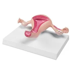 Modèle d'utérus sain, taille réelle