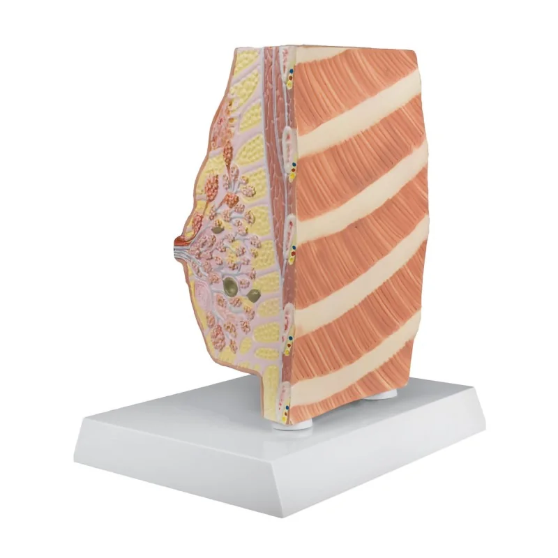 Modèle du sein avec maladies, taille réelle 3 Modèle du sein avec maladies, taille réelle 3