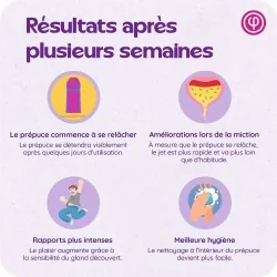 Kit Phimosis - Anneaux + huile + crème