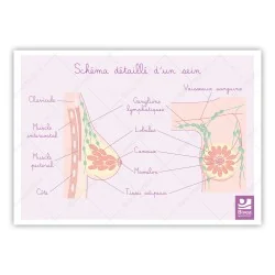 Carte différents stades du cancer du sein et schémas détaillés du sein