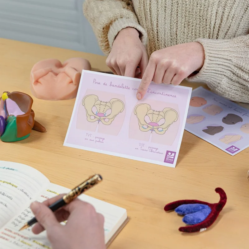 Carte anatomique Pose de bandelette Carte anatomique Pose de bandelette