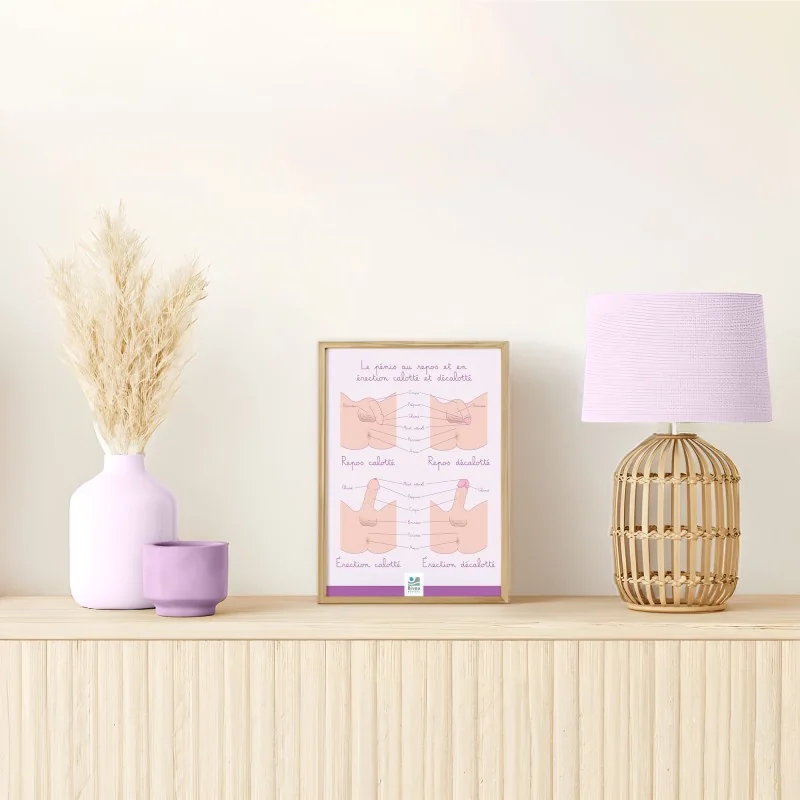 Poster Le pénis calotté et décalotté encadré