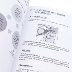 Cancer de la prostate : comprendre, anticiper, guérir