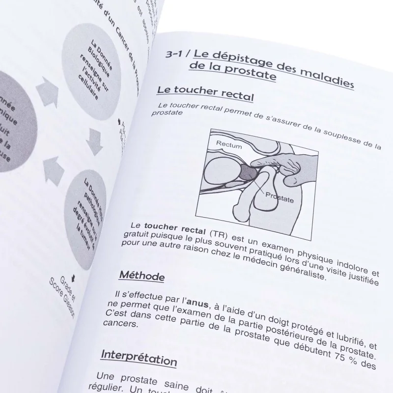 Cancer de la prostate : comprendre, anticiper, guérir