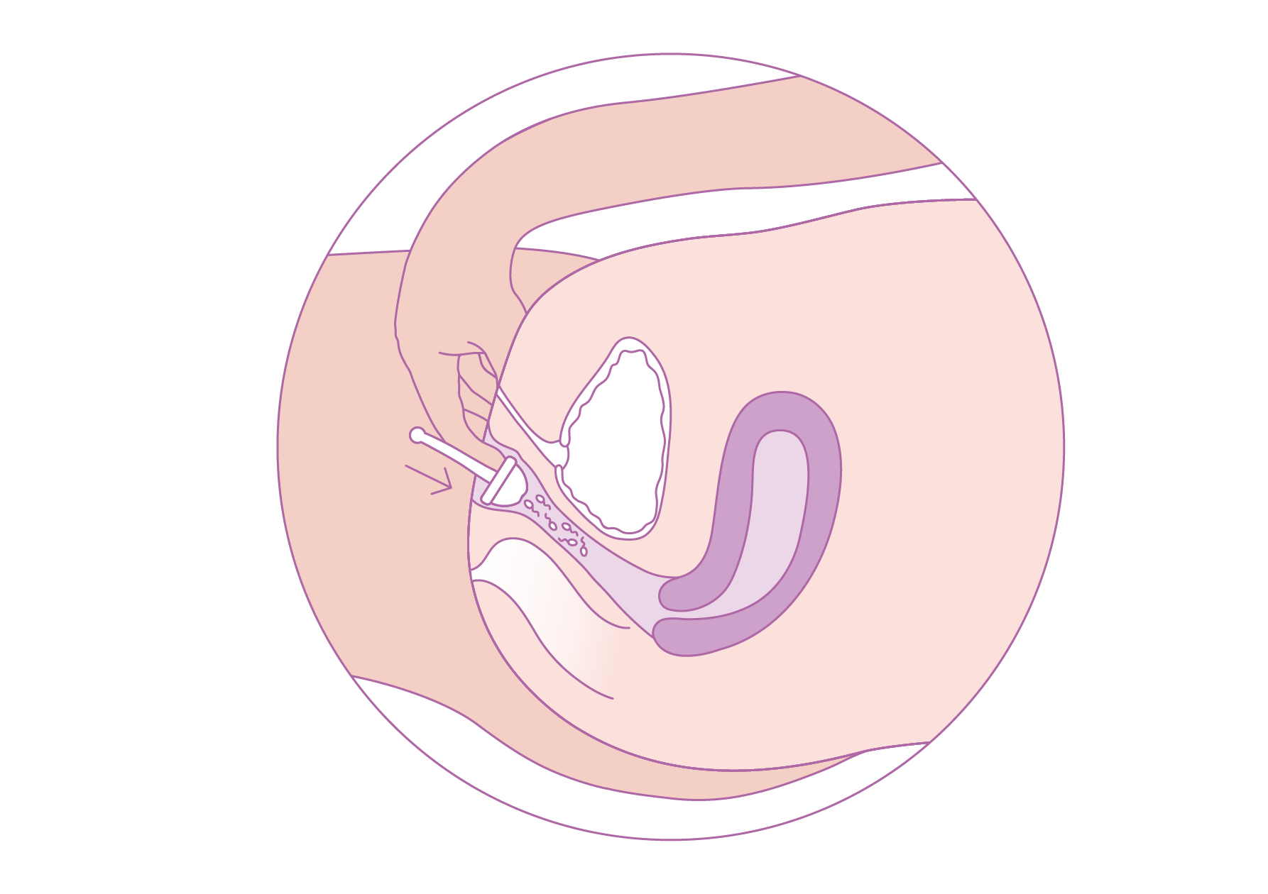 schéma-placement-coupe